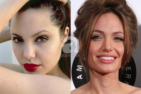 Điểm lại những nghi án phẫu thuật thẩm mỹ của Angelina Jolie 2