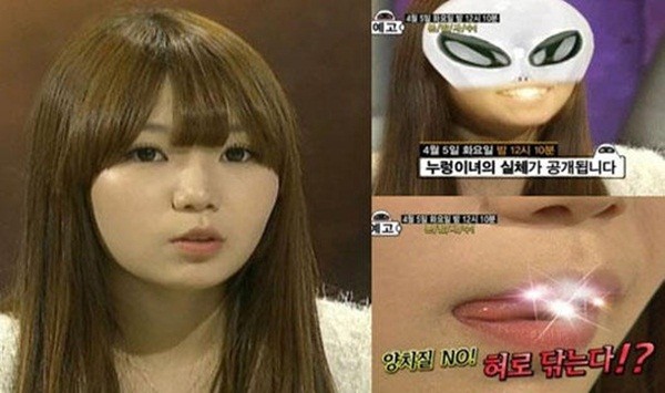 Hàn Quốc: Kỳ lạ cô nàng 10 năm liền không đánh răng 1