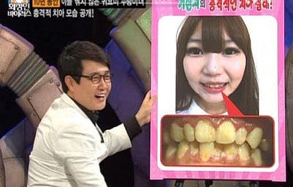 Hàn Quốc: Kỳ lạ cô nàng 10 năm liền không đánh răng 4