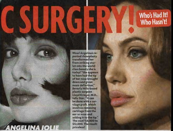 Điểm lại những nghi án phẫu thuật thẩm mỹ của Angelina Jolie 6