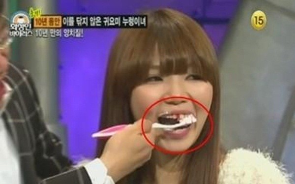 Hàn Quốc: Kỳ lạ cô nàng 10 năm liền không đánh răng 6