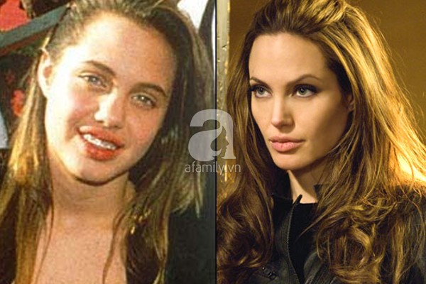 Điểm lại những nghi án phẫu thuật thẩm mỹ của Angelina Jolie 5