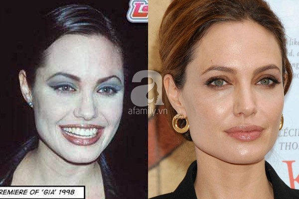 Điểm lại những nghi án phẫu thuật thẩm mỹ của Angelina Jolie 10