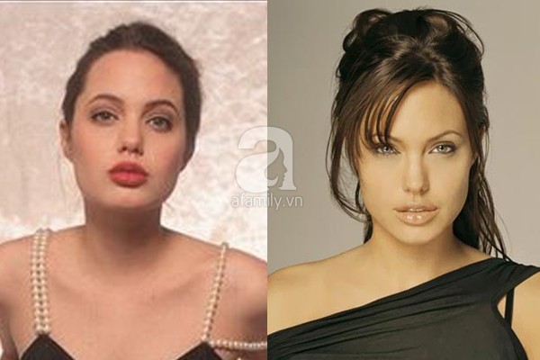 Điểm lại những nghi án phẫu thuật thẩm mỹ của Angelina Jolie 7
