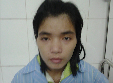 Nguyễn Thị Lý đang điều trị trong bệnh viện