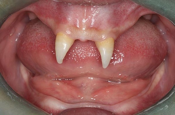 Những hàm răng kỳ lạ nhất &quot;quả đất&quot; 5