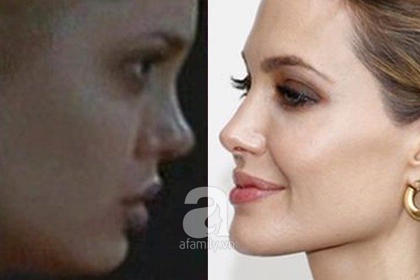 Điểm lại những nghi án phẫu thuật thẩm mỹ của Angelina Jolie 4